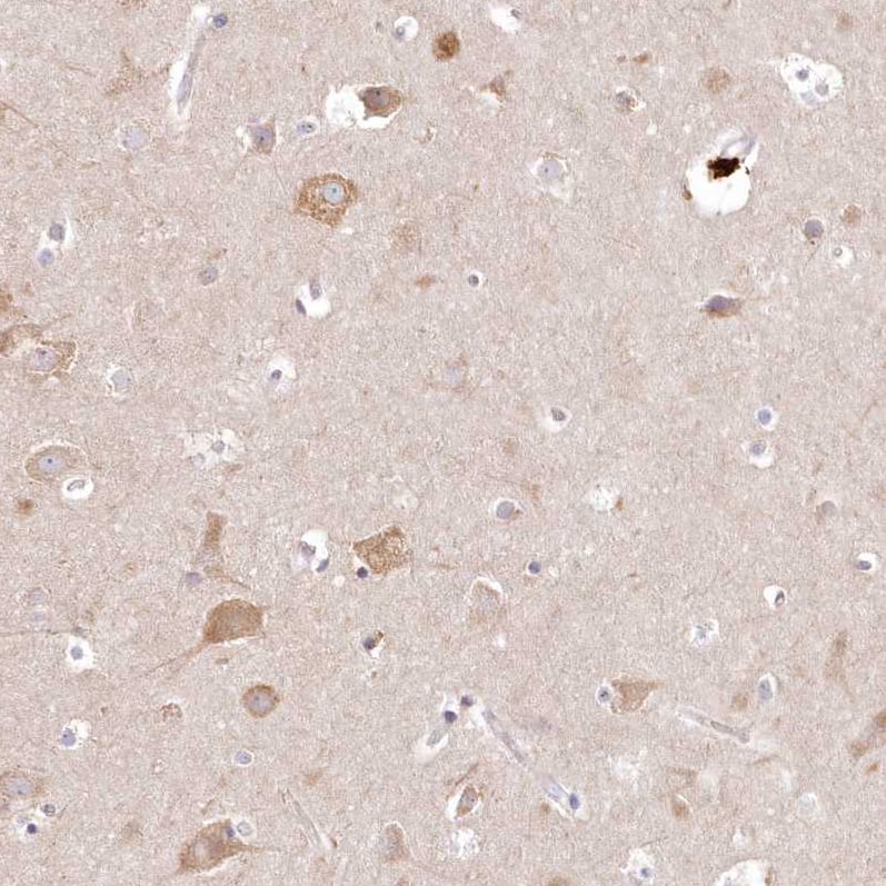 Staining of human cerebral cortex shows moderate cytoplasmic positivity in neuronal cells.