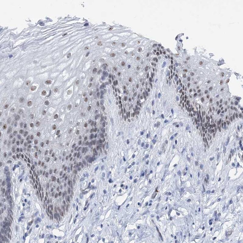 Staining of human squamous epithelia shows weak nuclear positivity in squamous epithelial cells.