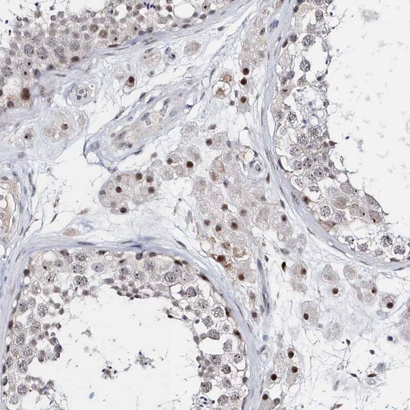 Staining of human testis shows strong nuclear positivity in Leydig cells.