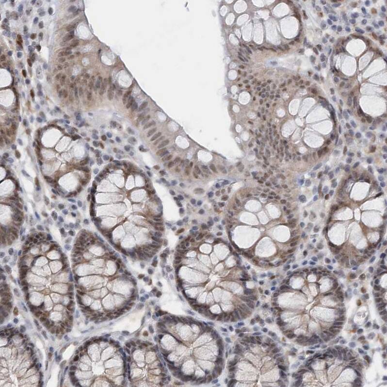 Staining of human colon shows moderate nuclear positivity in glandular cells.