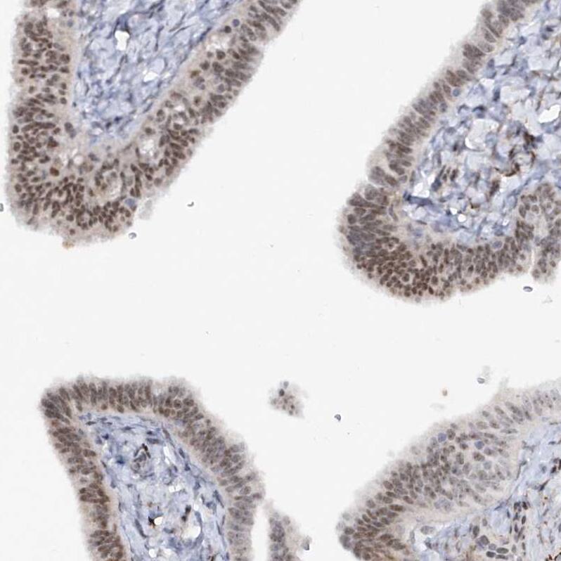 Staining of human fallopian tube shows moderate nuclear positivity in glandular cells.