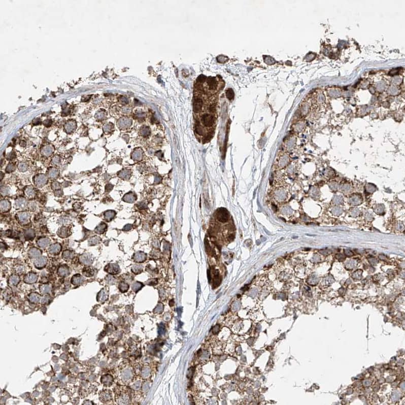 Staining of human testis shows moderate to strong cytoplasmic positivity in Leydig cells.