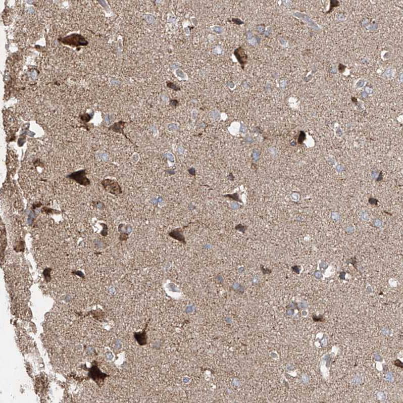 Staining of human cerebral cortex shows moderate to strong cytoplasmic positivity in neurons.