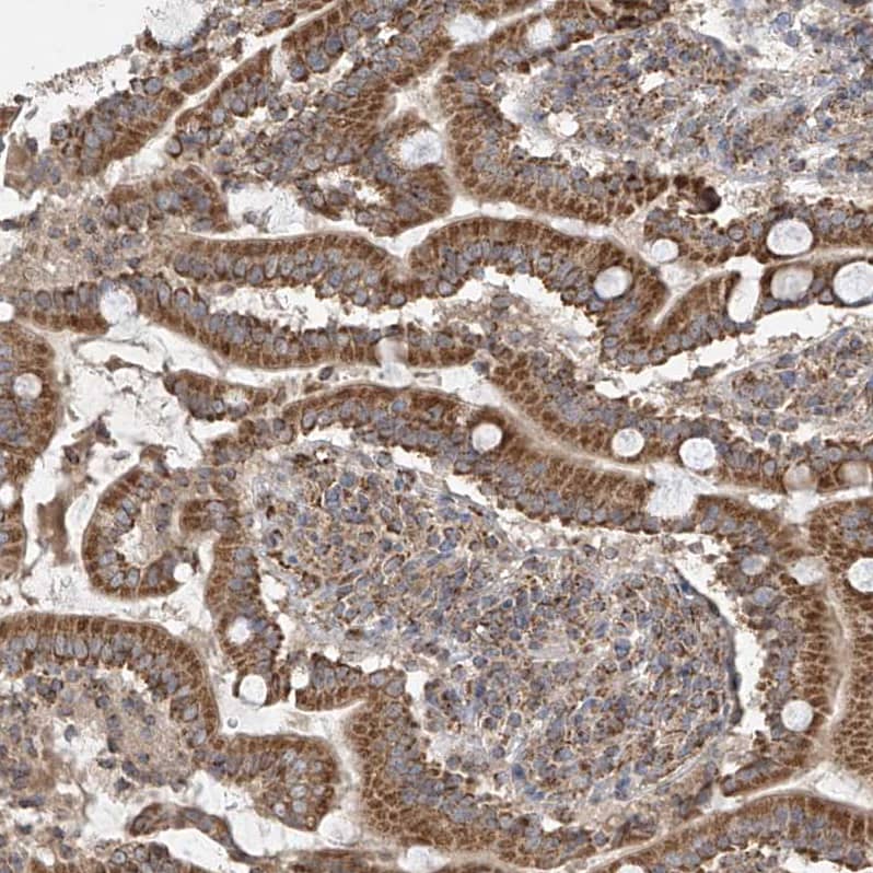 Staining of human duodenum shows moderate to strong cytoplasmic positivity in glandular cells.