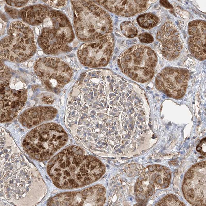 Staining of human kidney shows moderate to strong cytoplasmic positivity in cells in tubules.