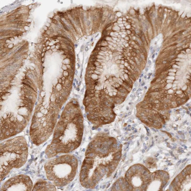 Staining of human stomach shows moderate cytoplasmic positivity in glandular cells.