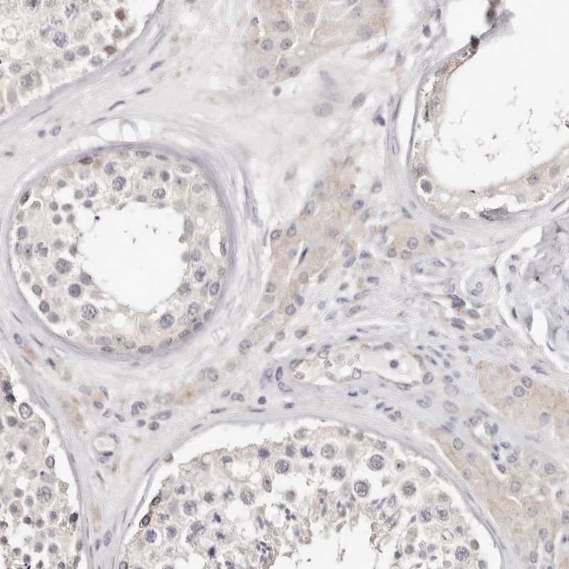 Staining of human testis shows no positivity in cells in seminiferous ducts as expected.