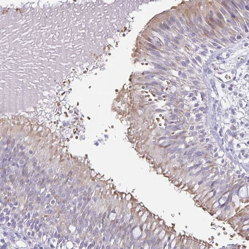 Immunohistochemistry FAM162B Antibody - BSA Free