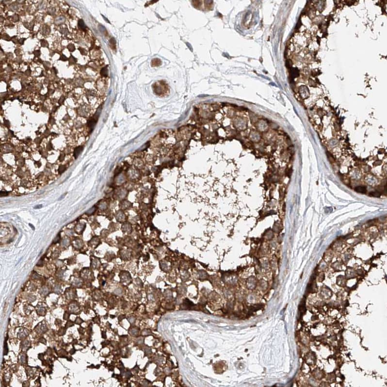 Immunohistochemistry CEP85L Antibody - BSA Free