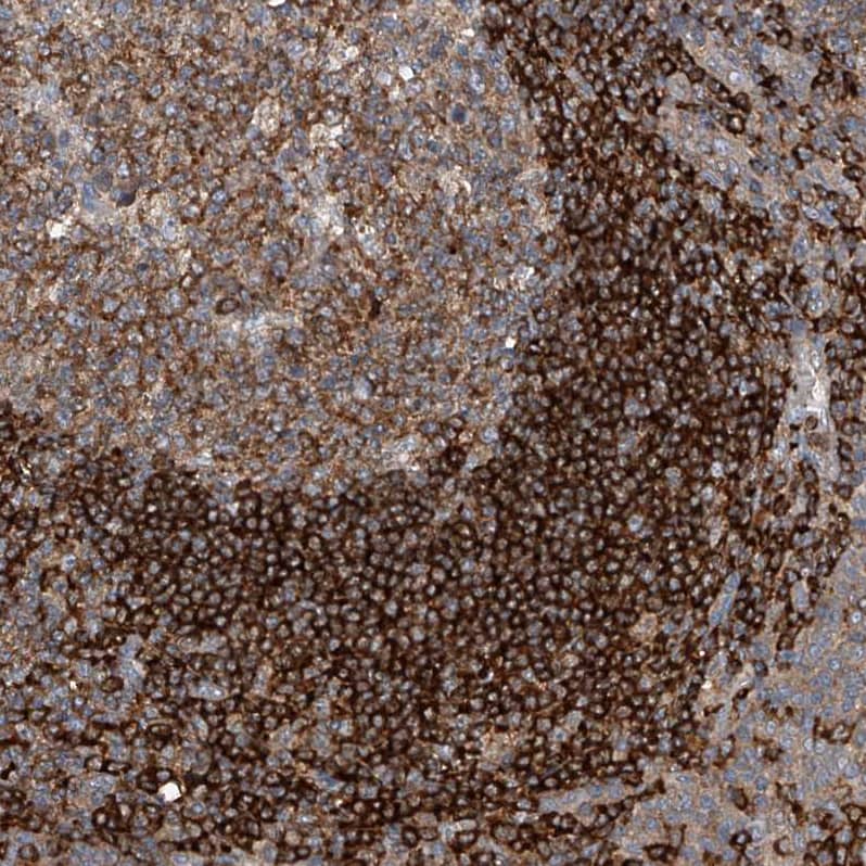 Immunohistochemistry CEP85L Antibody - BSA Free