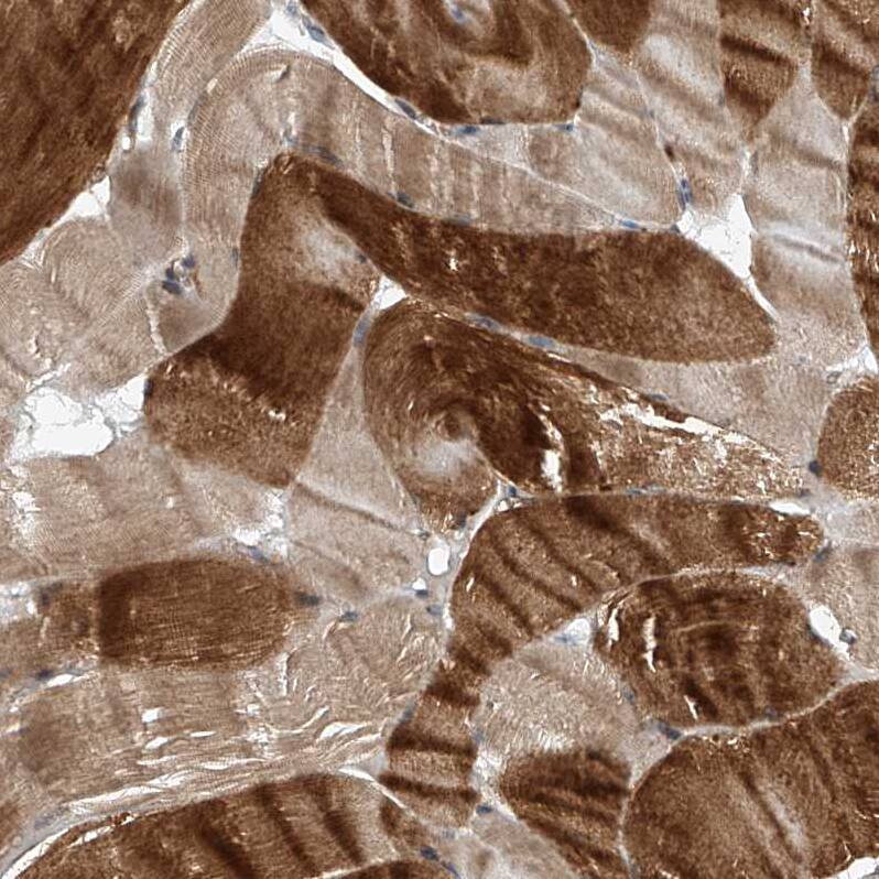 Immunohistochemistry CEP85L Antibody - BSA Free