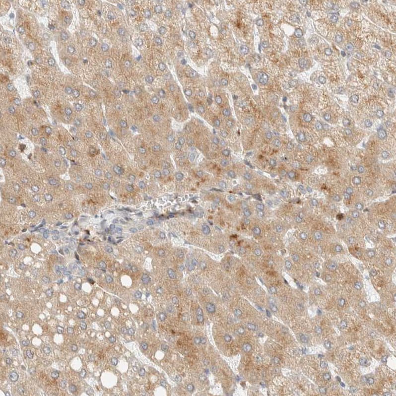 Staining of human liver shows moderate cytoplasmic positivity in hepatocytes.