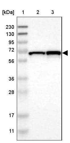 Western Blot DENND4C Antibody - BSA Free