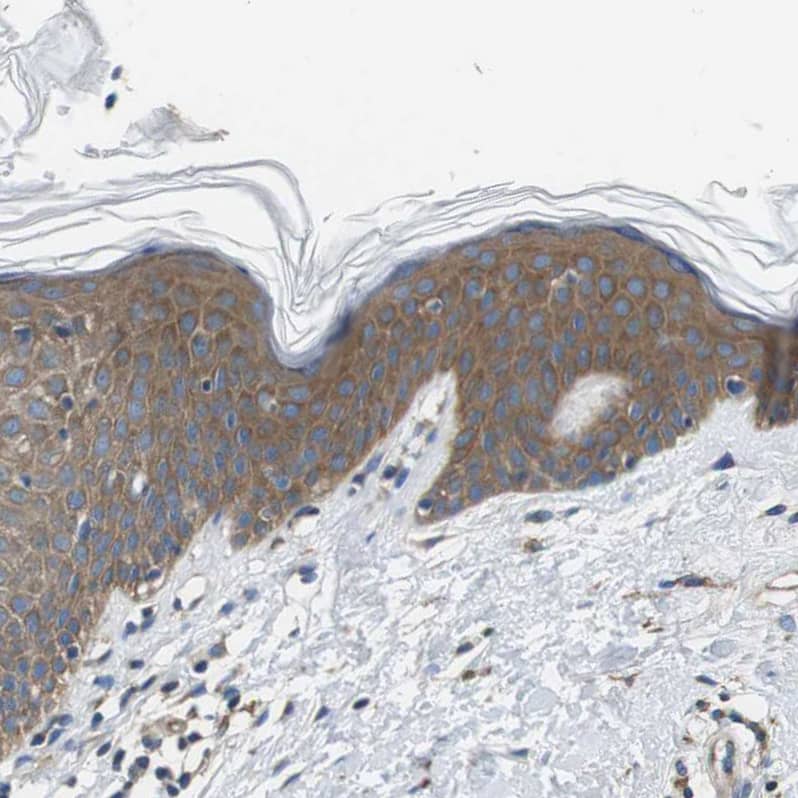 Staining of human skin shows moderate cytoplasmic positivity in squamous epithelial cells.