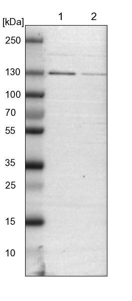 Lane 1: NIH-3T3 cell lysate (Mouse embryonic fibroblast cells)Lane 2: NBT-II cell lysate (Rat Wistar bladder tumour cells)