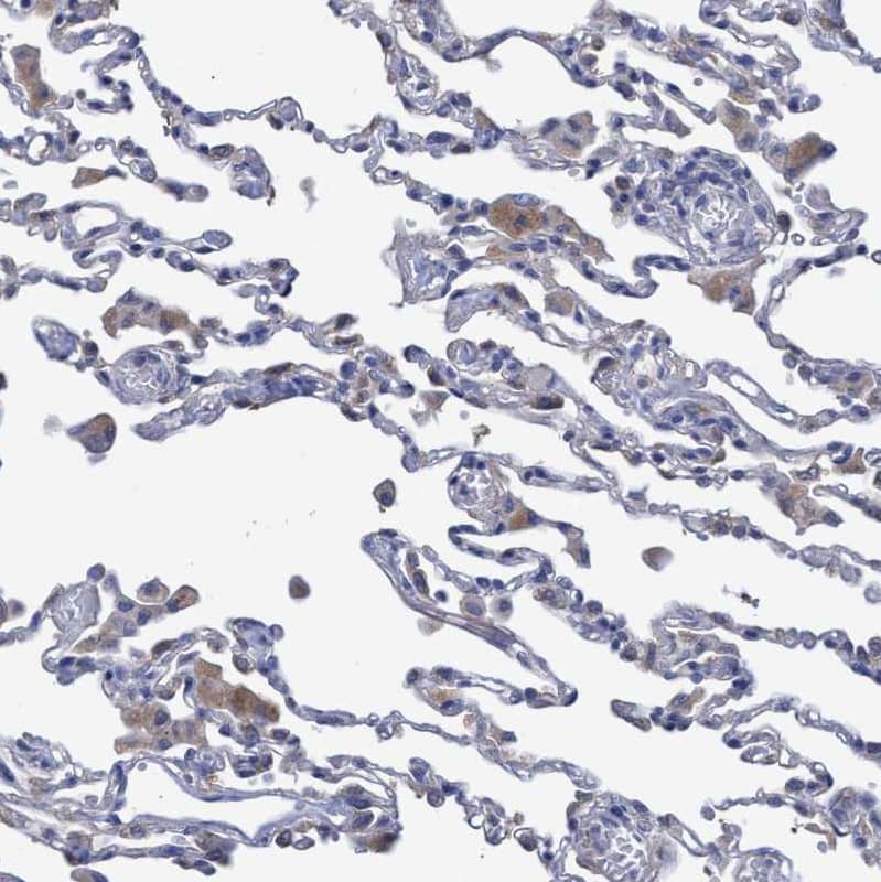 Staining of human Lung shows moderate cytoplasmic positivity in macrophages.