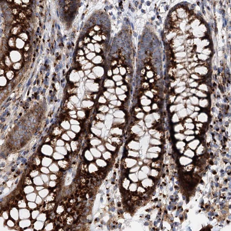 Staining of human colon shows strong cytoplasmic positivity(granular pattern) in glandular cells.