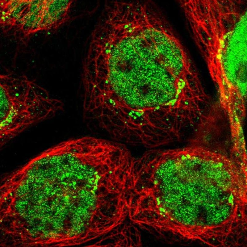 Staining of human cell line A-431 shows localization to nucleoplasm & the Golgi apparatus.