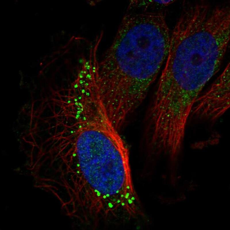 Staining of human cell line U-251 MG shows localization to vesicles.
