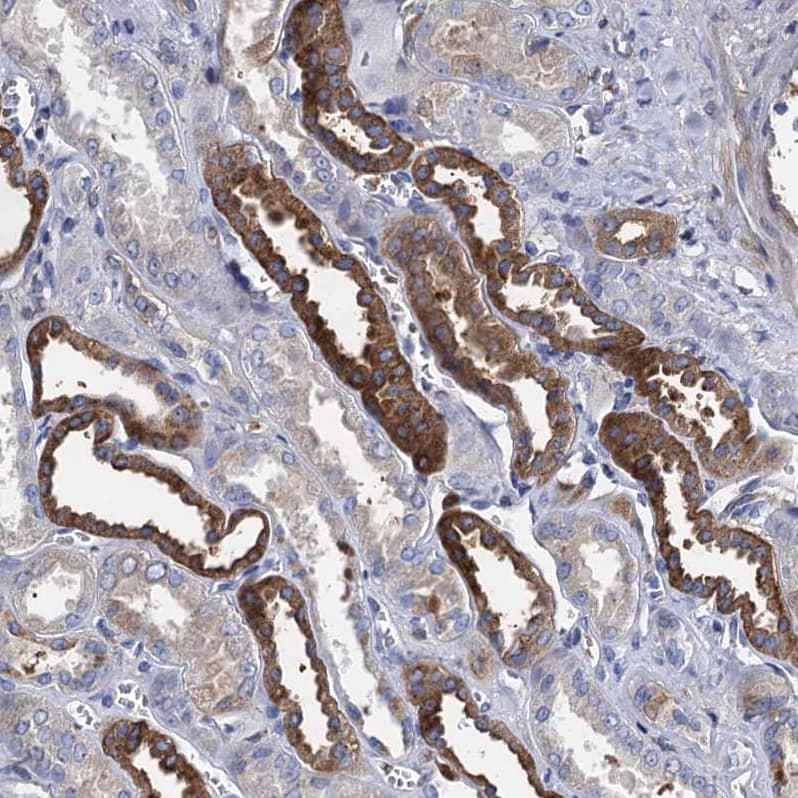 Immunohistochemistry-Paraffin TMEM72 Antibody - BSA Free