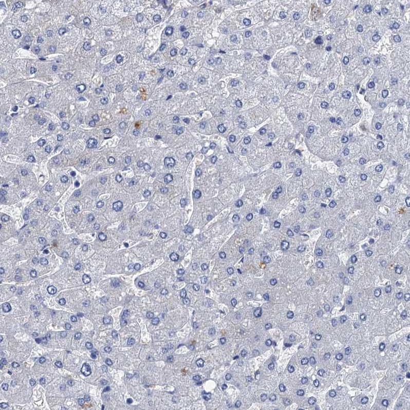 Immunohistochemistry-Paraffin TMEM72 Antibody - BSA Free