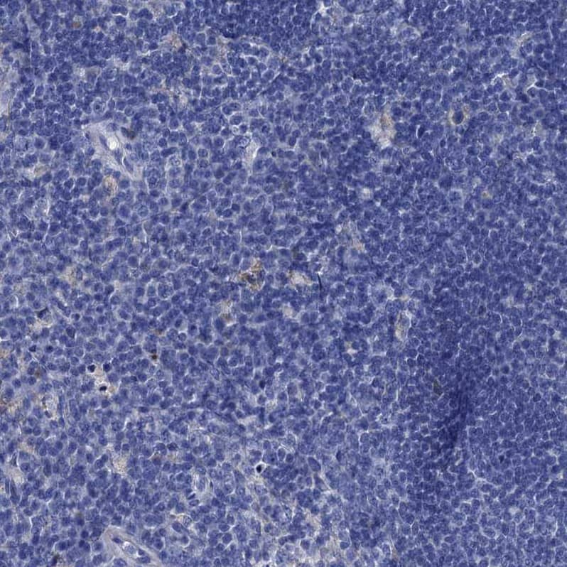 Immunohistochemistry-Paraffin TMEM72 Antibody - BSA Free