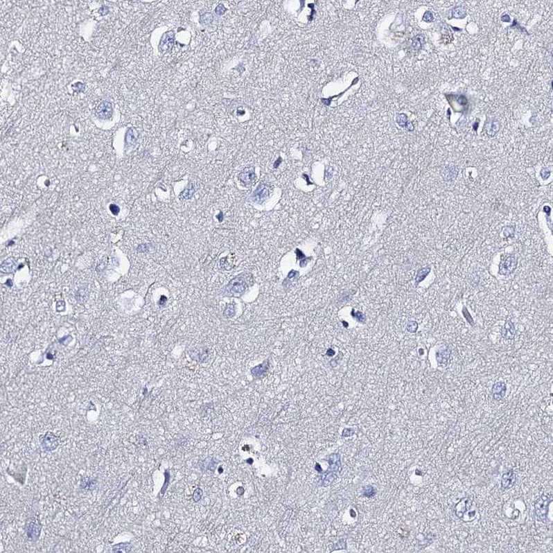 Immunohistochemistry-Paraffin TMEM72 Antibody - BSA Free