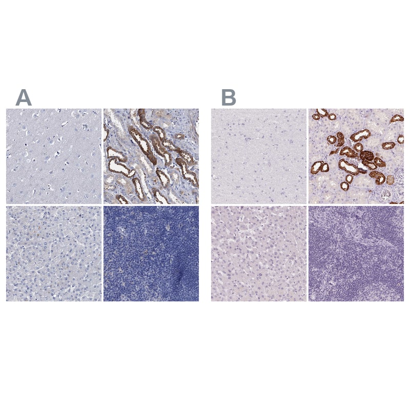 Immunohistochemistry-Paraffin TMEM72 Antibody - BSA Free
