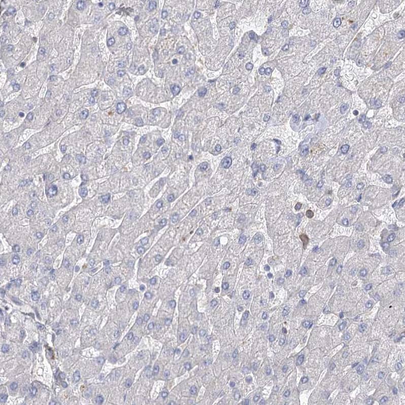 Staining of human liver shows no positivity in hepatocytes as expected.