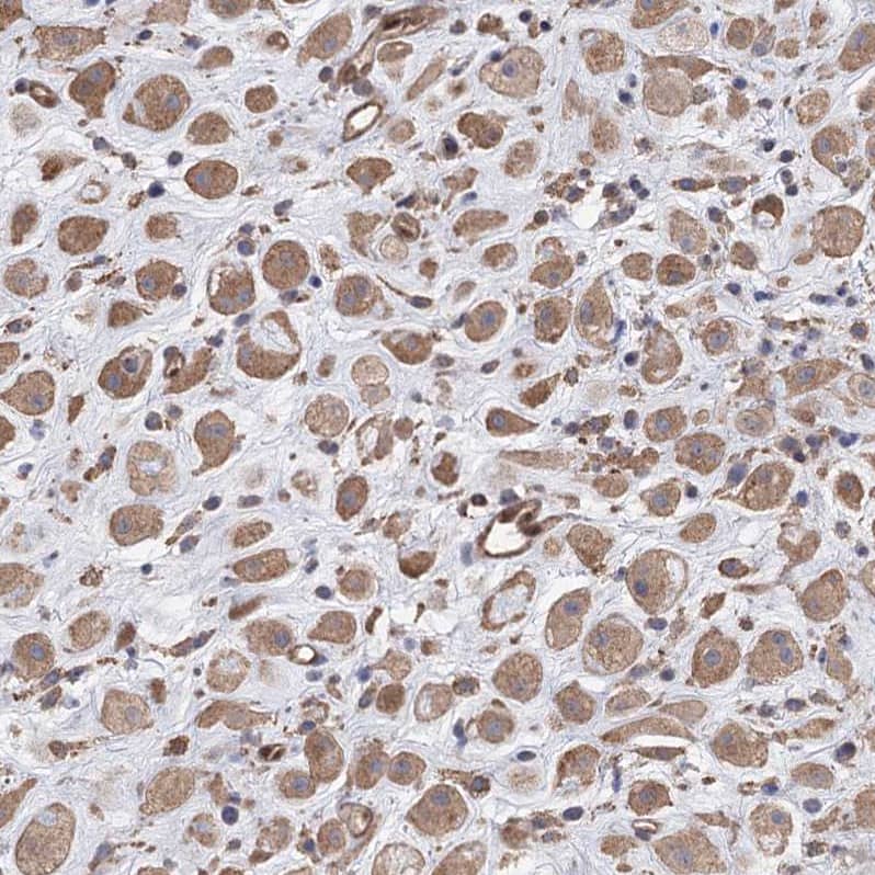 Staining of human placenta shows moderate cytoplasmic positivity in decidual cells.