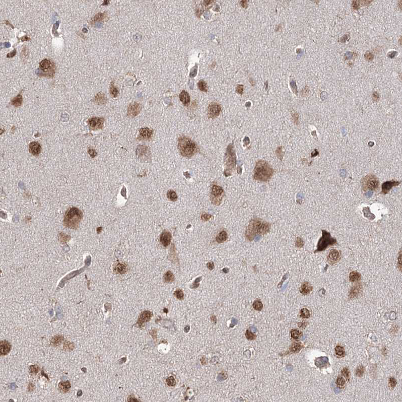 Staining of human cerebral cortex shows moderate nuclear and cytoplasmic positivity in neurons.