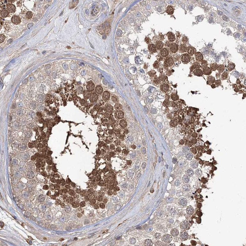 Staining of human testis shows moderate nuclear and cytoplasmic positivity in cells in seminiferous ducts.