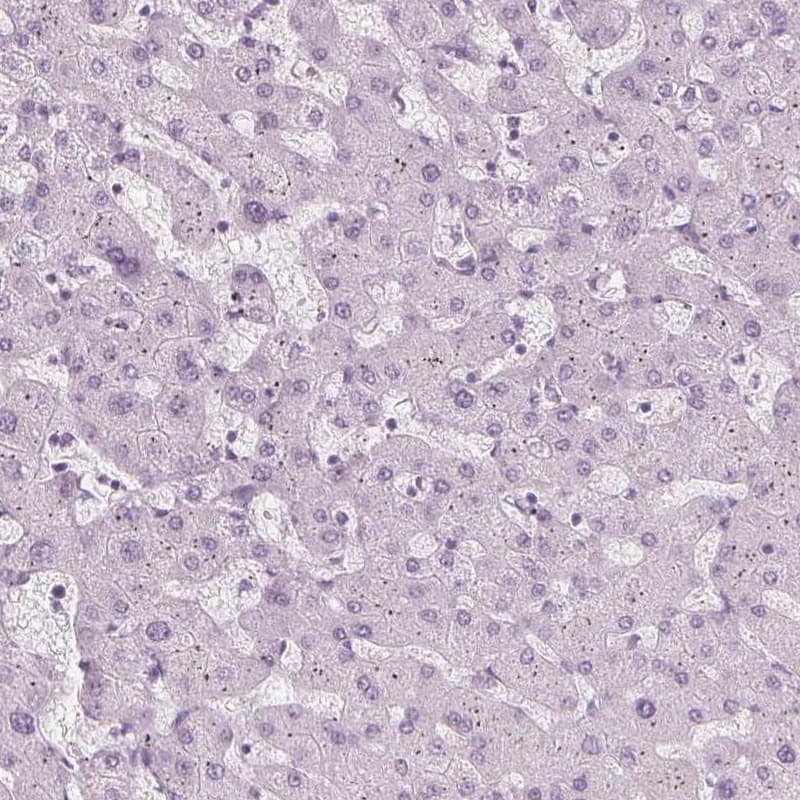 Staining of human liver shows low expression as expected.