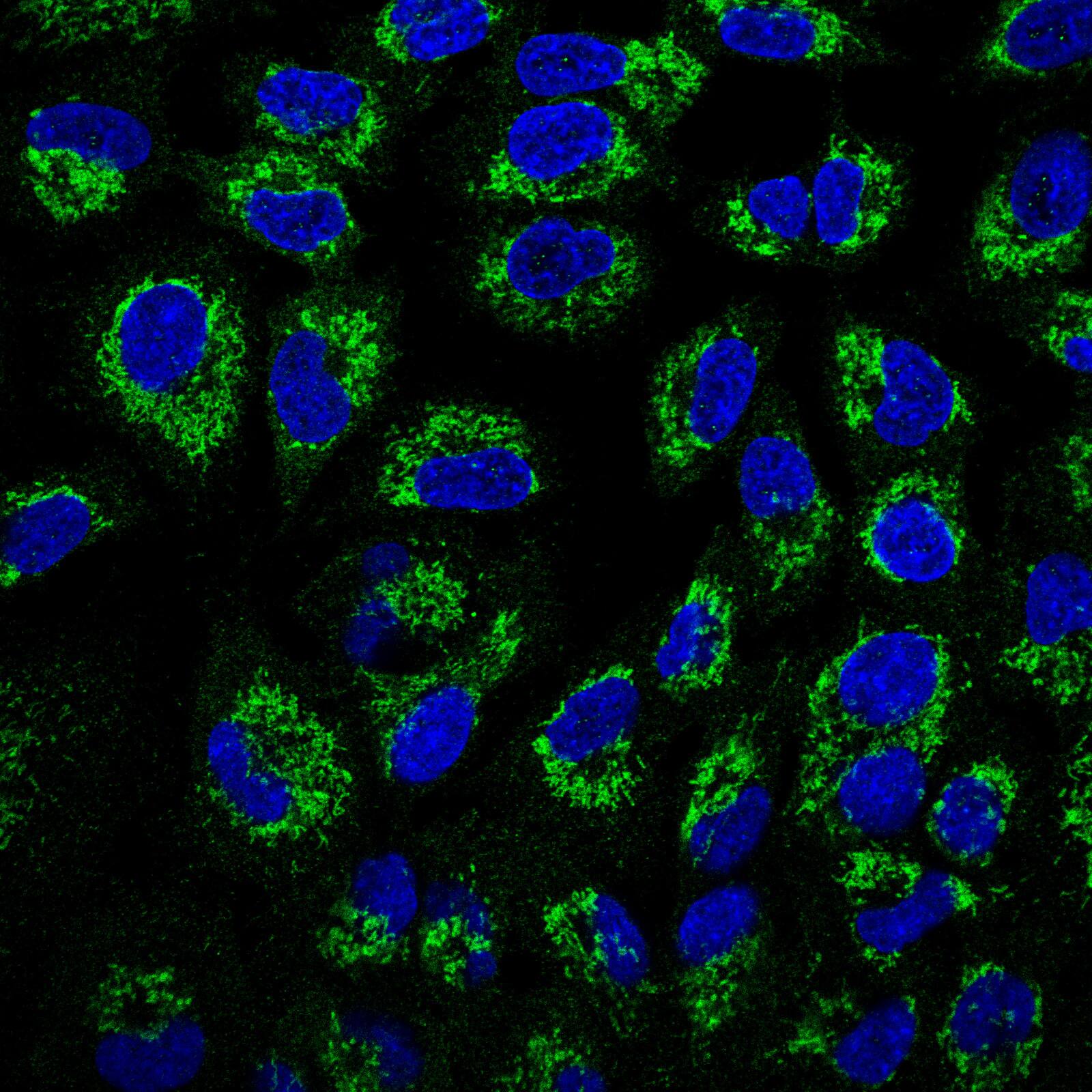 Staining of human cell line A-549 using Anti-ATP5B antibody HPA001520, showing protein localization to Mitochondria (green). Microtubule and nuclear probes are visualized in red and blue, respectively (where available).