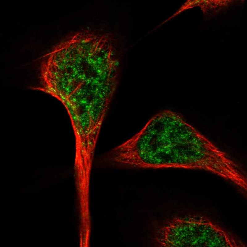 Staining of human cell line U-2 OS shows localization to nuclear speckles.