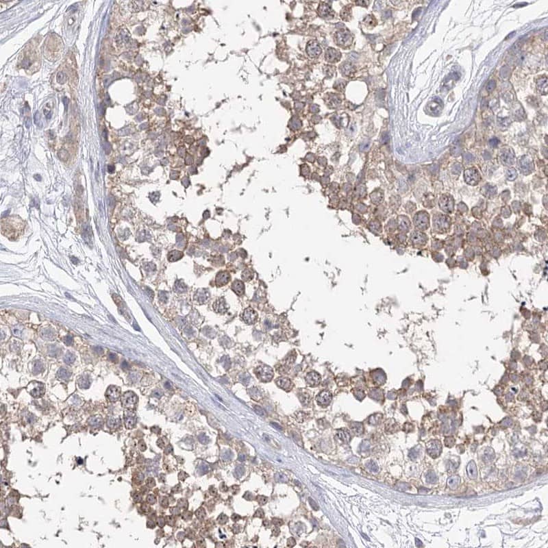 Immunohistochemistry Aurora C Antibody - BSA Free