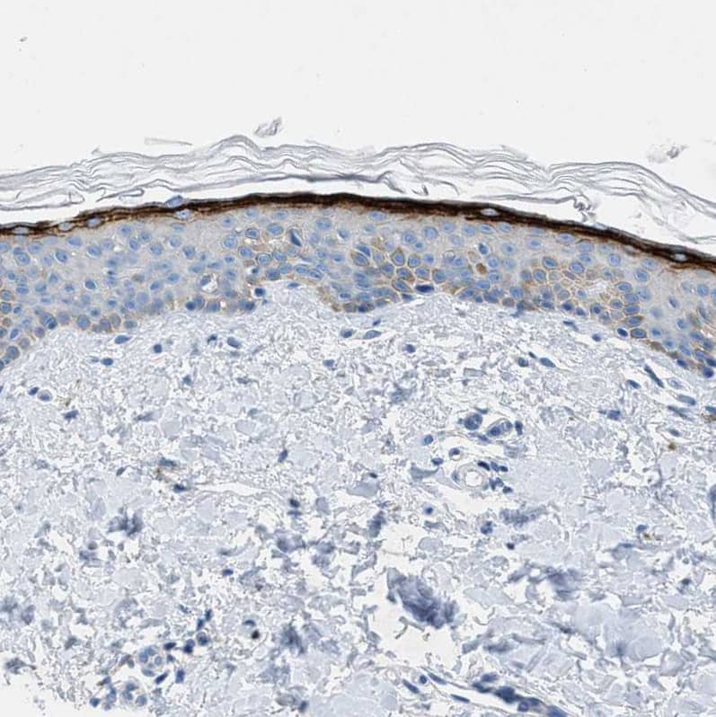 Immunohistochemistry TMEM180 Antibody - BSA Free