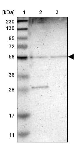 Western Blot TMEM180 Antibody - BSA Free