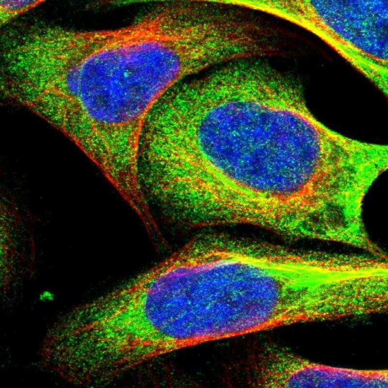 Staining of human cell line U-2 OS shows localization to cytosol.
