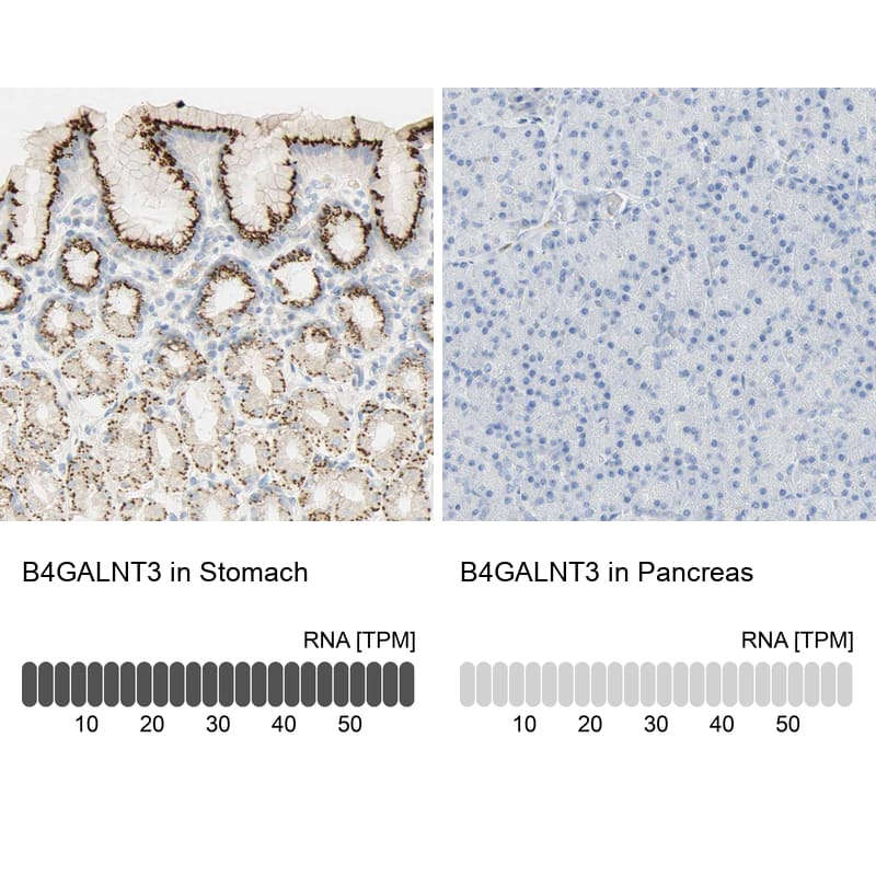 Analysis in human stomach and pancreas tissues using NBP1-90836 antibody. Corresponding B4GALNT3 RNA-seq data are presented for the same tissues.