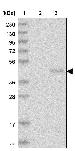 Lane 1: Marker [kDa] 230, 130, 95, 72, 56, 36, 28, 17, 11Lane 2: Human cell line RT-4Lane 3: Human cell line U-251MG sp