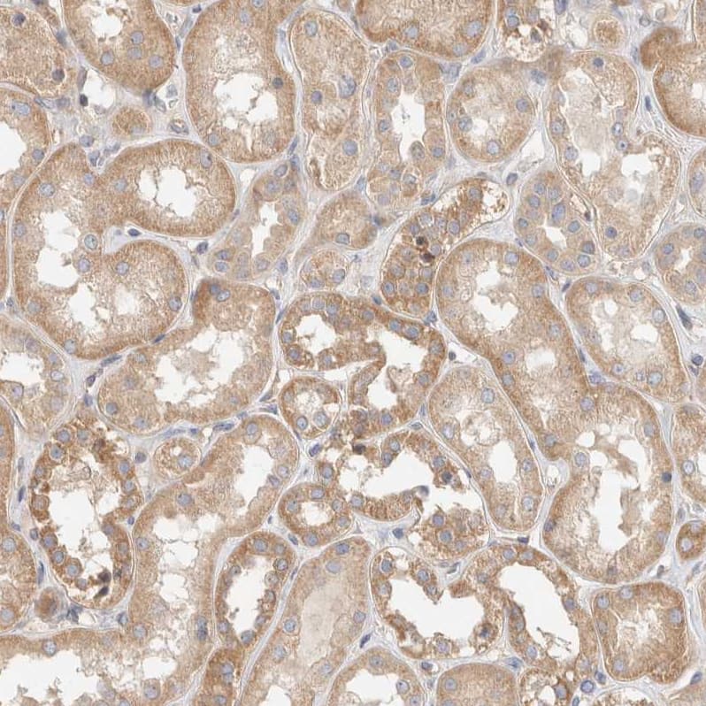 Staining of human kidney shows moderate cytoplasmic-membranous positivity in cells in tubules.