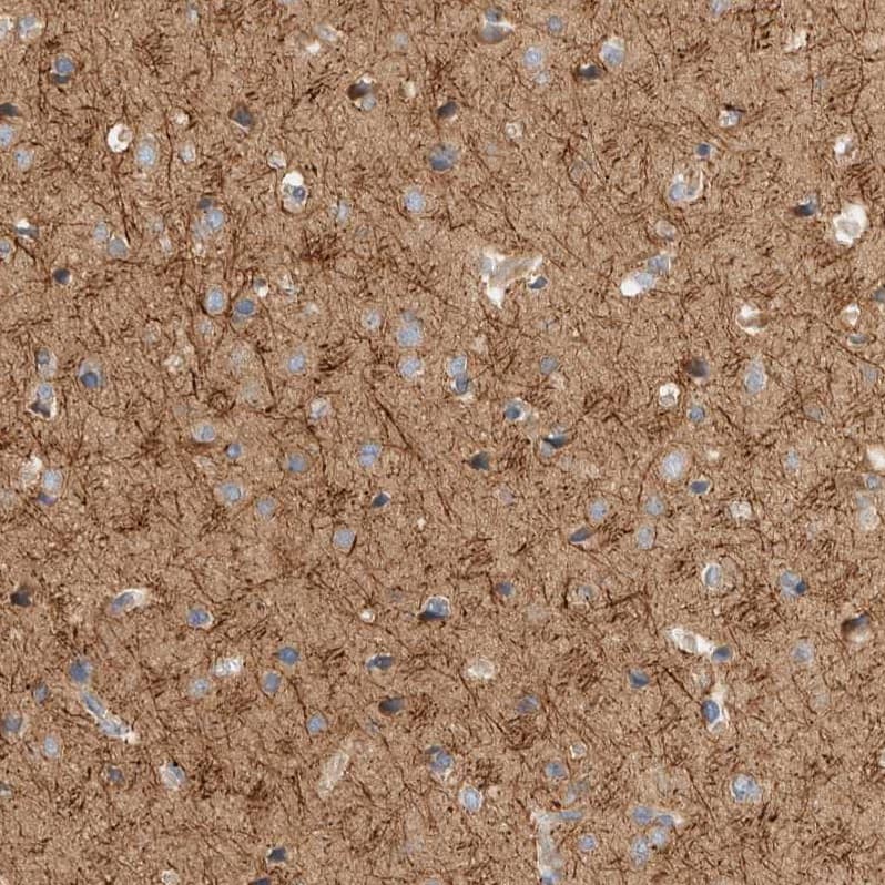 Staining of human cerebral cortex shows strong cytoplasmic-membranous positivity in neuropil.