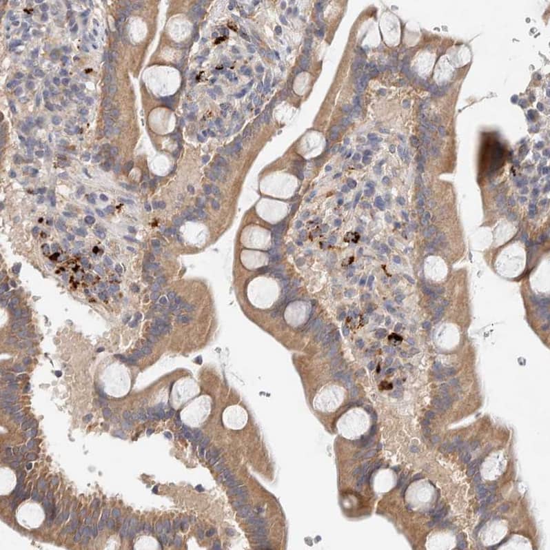 Staining of human duodenum shows moderate cytoplasmic-membranous positivity in glandular cells.