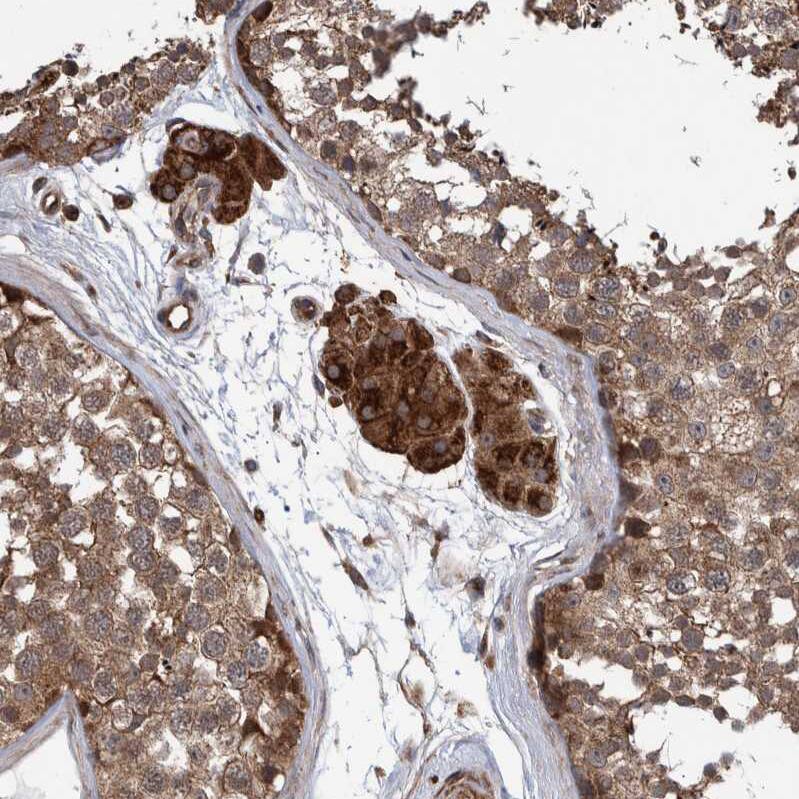 Staining of human testis shows strong cytoplasmic positivity in Leydig cells.