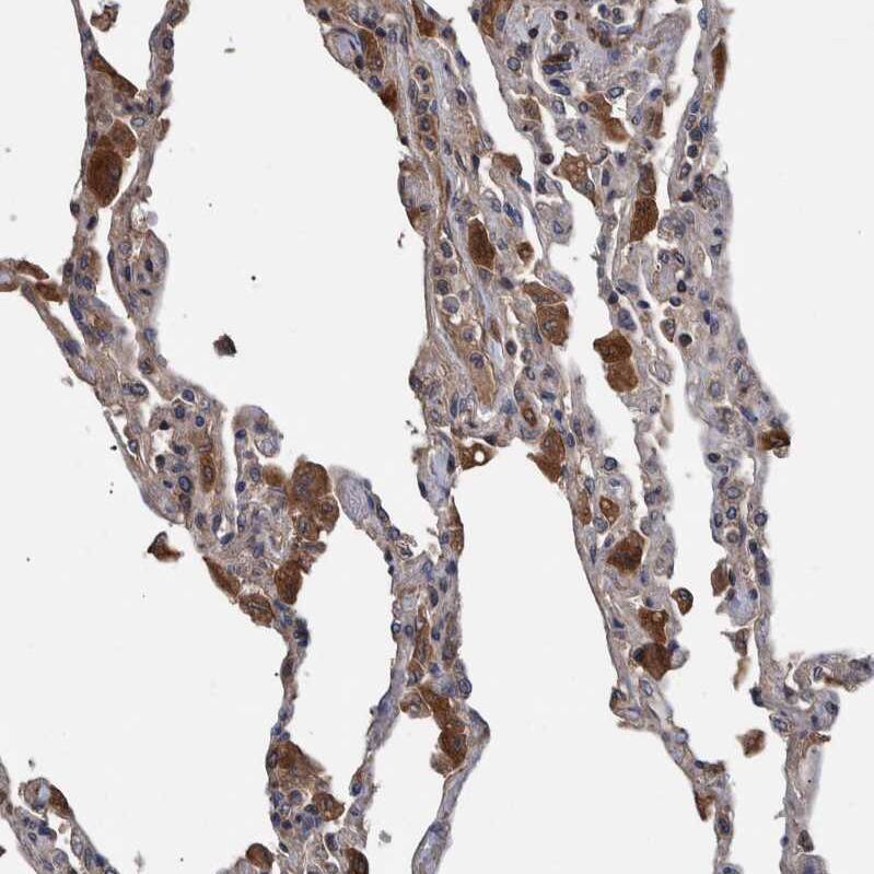 Staining of human lung shows strong cytoplasmic positivity in macrophages.
