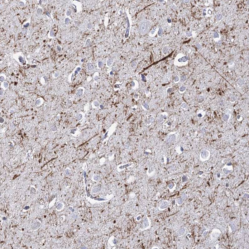 Staining of human cerebral cortex shows strong positivity in neuronal processes.