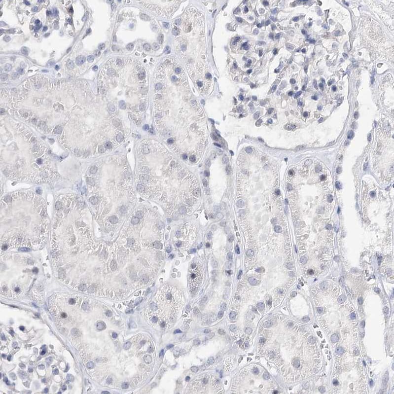 Staining of human kidney shows no positivity in cells in tubules as expected.