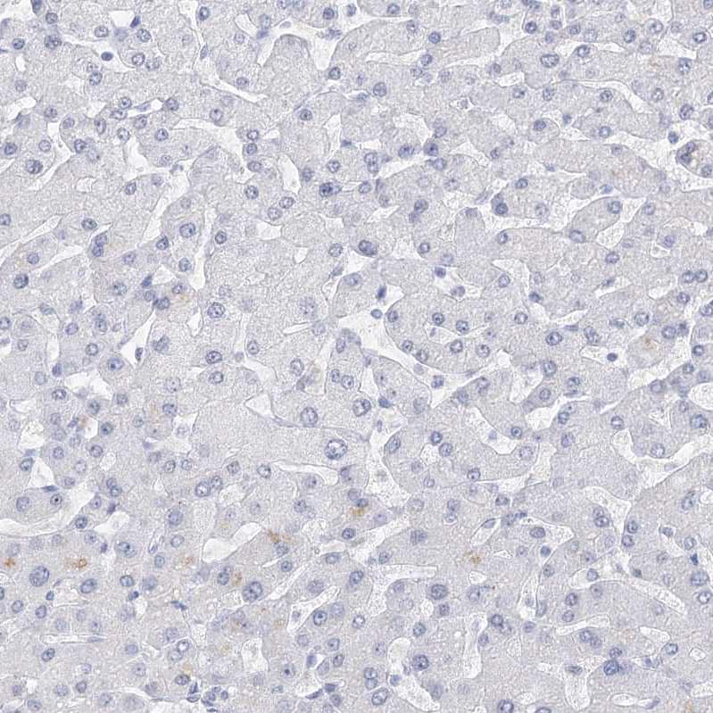 Staining of human liver shows no positivity in hepatocytes as expected.