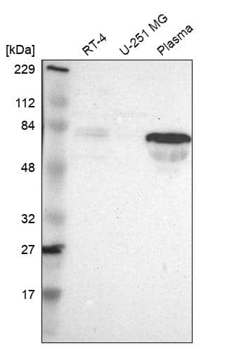Analysis in human cell line RT-4, human cell line U-251 MG and human plasma.